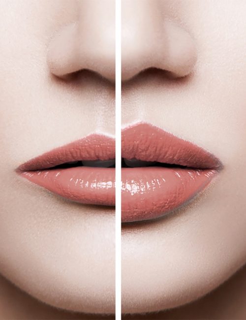 Fillers Beauty To Be Fillers Beauty To Be